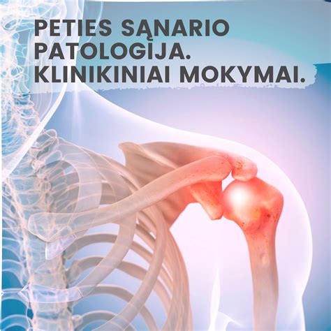 Gydytojo atliekamas peties sąnario fizinis ištyrimas