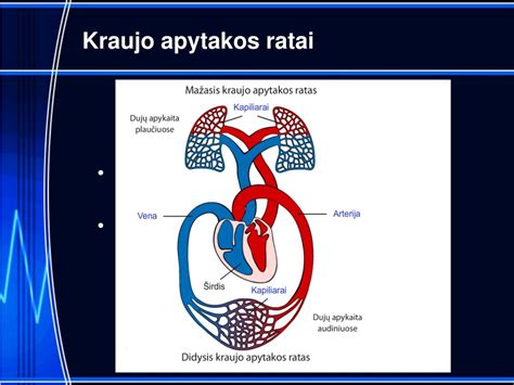 Dirbtinės kraujo apytakos aparato schema