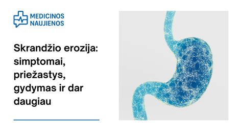 Skrandžio rūgštingumo simptomai ir jo poveikis virškinimo sistemai