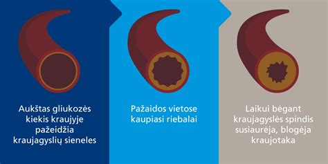 Širdies schema su rodyklėmis, rodančiomis miego įtaką