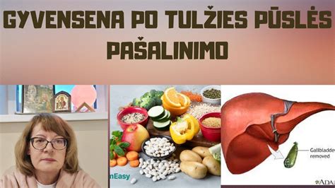 Tulžies pūslės anatomijos schema