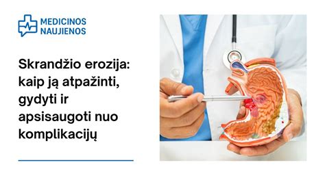 Skrandžio gleivinės pažeidimai ir opaligės formavimasis