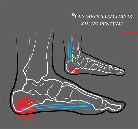 Kulno pentino sandara