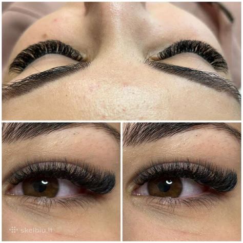 Blakstienų priauginimas