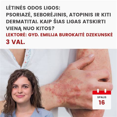Kaip teisingai atskirti kiaušinio baltymą nuo trynio