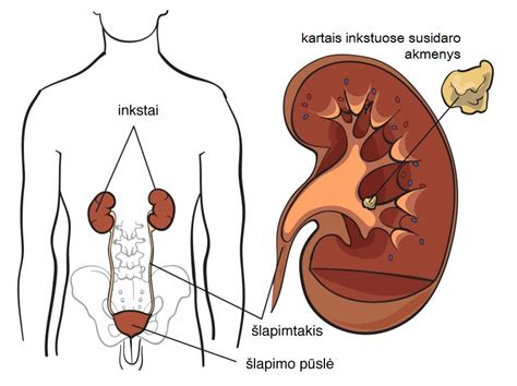 schematinis žmogaus inksto pavaizdavimas