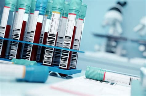 Laboratoriniai tyrimai prieš skiriant sisteminį priešgrybelinį gydymą