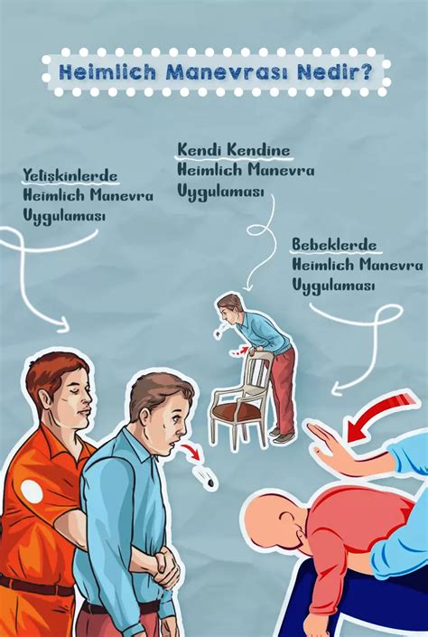 Heimlicho manevro atlikimo schema
