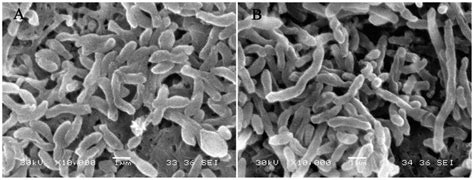 Bakterijų Proteus mirabilis ir Rhodopseudomonas palustris struktūra
