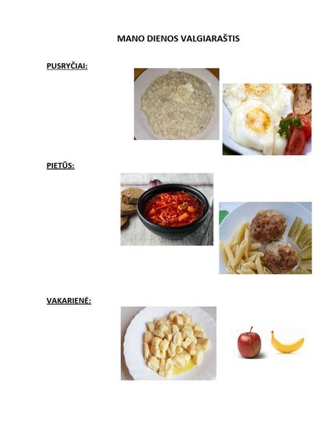 Pavyzdinis ligoninės valgiaraštis