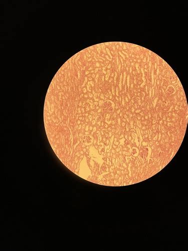 Mieliagrybių mikroskopinis vaizdas