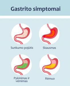 Gastrito simptomai ir diagnozė
