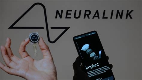 „Neuralink“ neurochirurginis robotas