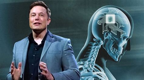 „Neuralink“ elektrodų išdėstymas ir signalų fiksavimas